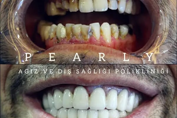 Özel Pearly Ağız ve Diş Sağlığı Polikliniği - Resim 11