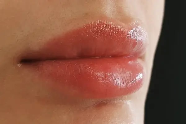 Op.Dr.Onur Serin Estetik, Plastik Cerrahi Uzmanı - Resim 11