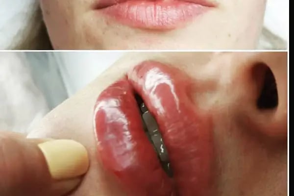 Op.Dr.Onur Serin Estetik, Plastik Cerrahi Uzmanı - Resim 10