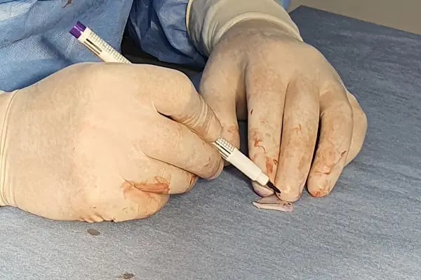 Prof.Dr.Mustafa DURĞUN Estetik Plastik ve Rekonstrüktif Cerrahi Uzmanı - Resim 9