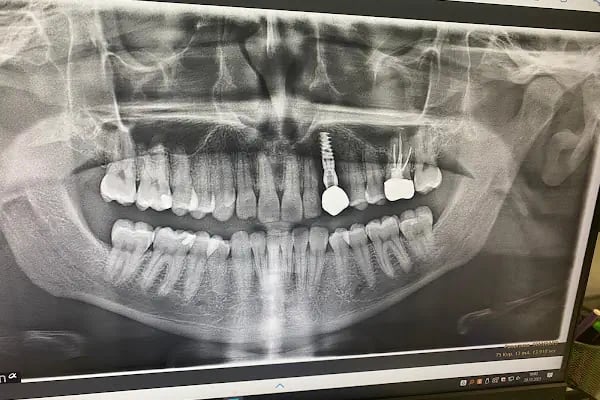 Dental Point Ağız ve Diş Sağlığı Polikliniği - Resim 3
