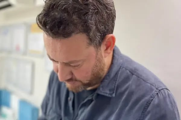 Op. Dr. Mustafa Öksüz Aydın Estetik ve Plastik Cerrahi ve Saç Ekim kliniği Botoks Dolgu - Resim 7
