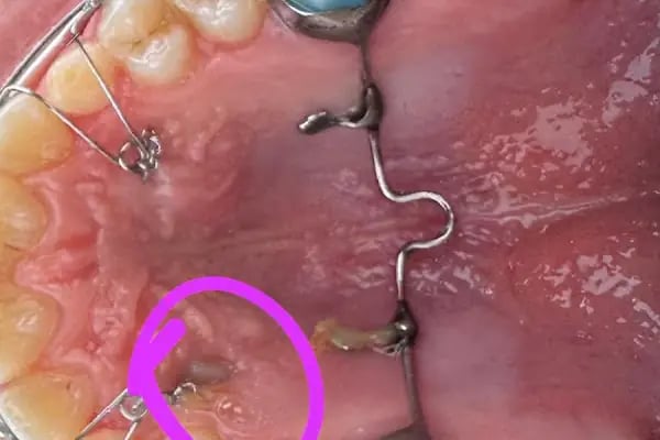 Özel Başiskele Ağız ve Diş Sağlığı Polikliniği - Resim 15