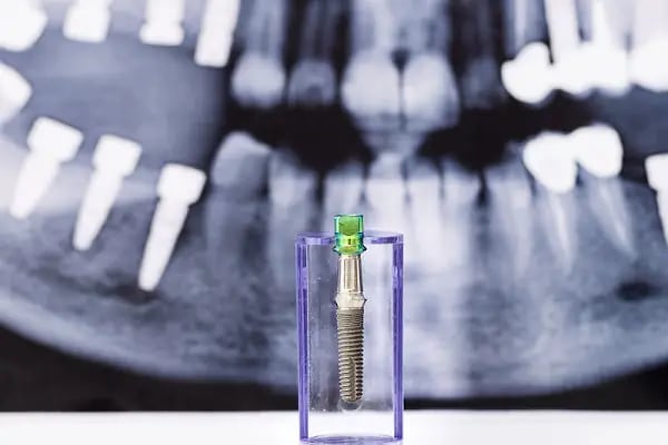 İzmir Dentalizm Ağız ve Diş Sağlığı Polikliniği, Diş Hekimliği - Resim 19