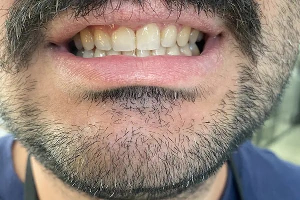 İzmir Dentalizm Ağız ve Diş Sağlığı Polikliniği, Diş Hekimliği - Resim 10
