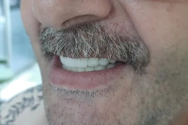 İzmir Dentalizm Ağız ve Diş Sağlığı Polikliniği, Diş Hekimliği - Resim 17