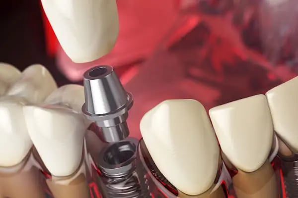 İzmir Dentalizm Ağız ve Diş Sağlığı Polikliniği, Diş Hekimliği - Resim 6
