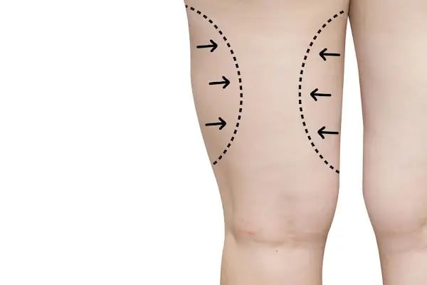 Op.Dr.Ünal Şahin - Plastik Cerrah | Burun Estetiği | Meme Estetiği | Liposuction | Dudak Dolgusu I Botoks - Resim 20