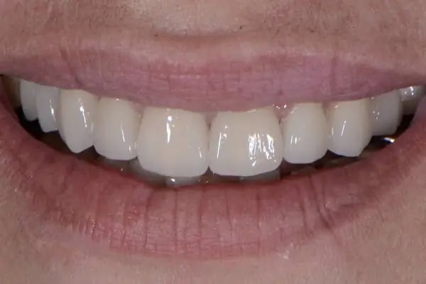 Özel ProfDent Kars Ağız ve Diş Sağlığı Polikliniği - Resim 17