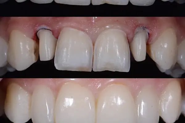 Özel ProfDent Kars Ağız ve Diş Sağlığı Polikliniği - Resim 12
