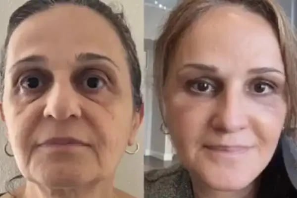 Doç. Dr. Fikret Eren Estetik, Plastik, Rekonstrüktif Cerrahi Kliniği Fikret Eren - Resim 15