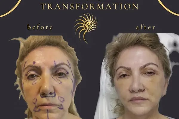 Doç. Dr. Fikret Eren Estetik, Plastik, Rekonstrüktif Cerrahi Kliniği Fikret Eren - Resim 6