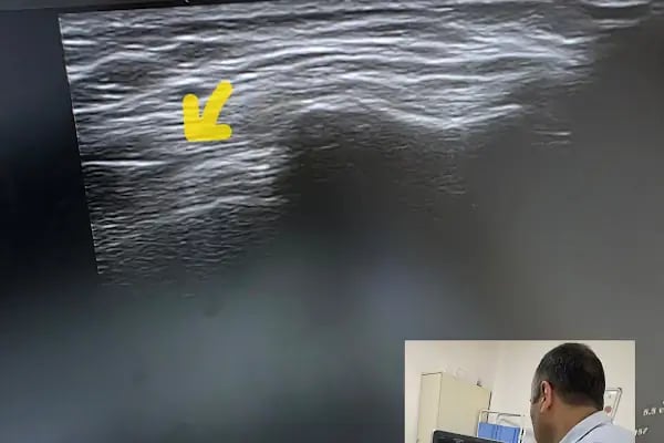 Uz.Dr.Volkan SUBAŞI-Fizik Tedavi Rehabilitasyon ve Tamamlayıcı tıp - Resim 17