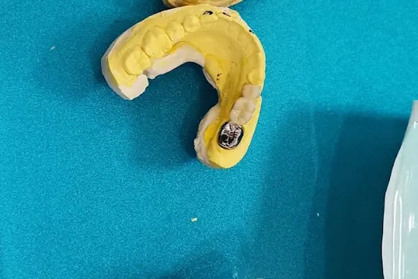 Denttaş Ağız ve Diş Sağlığı Polikliniği-MARDİN DİŞ HEKİMİ TANJU DEMIRTAŞ-dental klinik - Resim 10