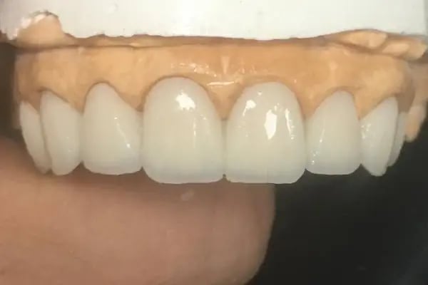 Denttaş Ağız ve Diş Sağlığı Polikliniği-MARDİN DİŞ HEKİMİ TANJU DEMIRTAŞ-dental klinik - Resim 18