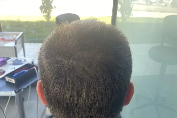 His Hair Center - Ankara - Resim 10