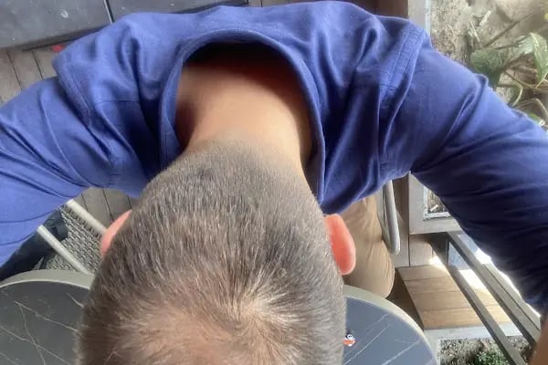 His Hair Center - Ankara - Resim 11