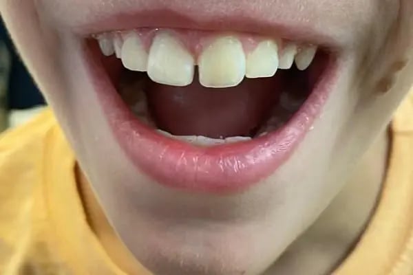 Dental Bodrum | Diş Hekimi Berna Atila - Resim 3