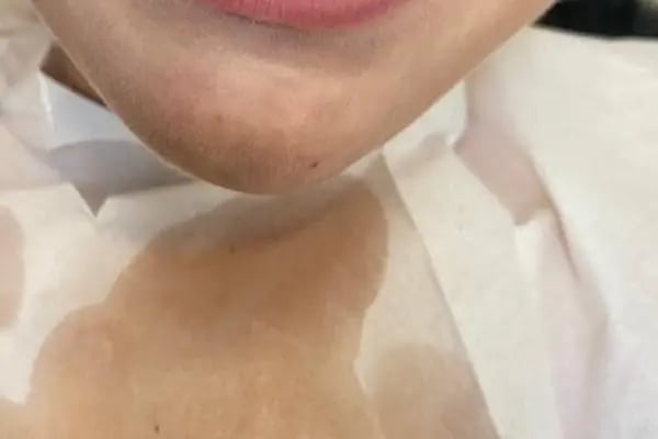 Dental Bodrum | Diş Hekimi Berna Atila - Resim 4