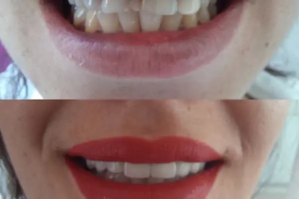 Dental Bodrum | Diş Hekimi Berna Atila - Resim 5