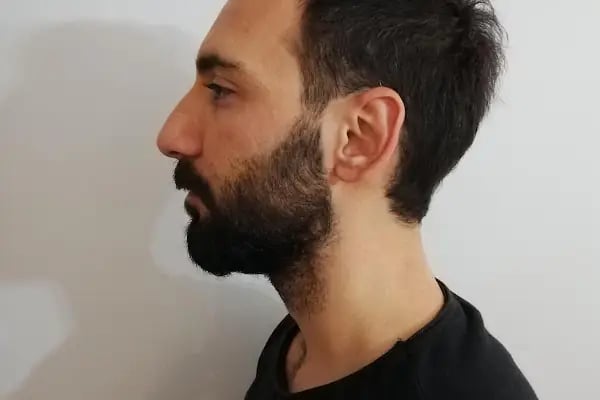 ORC Estetik Ve Plastik Cerrahi Kliniği - Opr. Dr Ömer Faruk ERİN - Resim 9