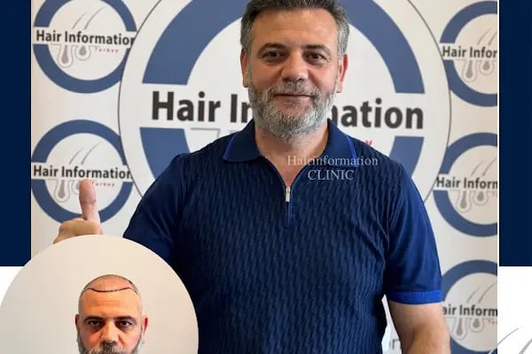Hair Information Clinic - Saç Ekimi - Resim 5