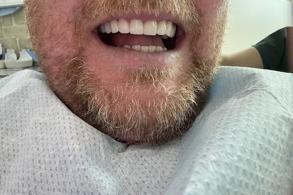 Op. Dr. Mehmet Çelik &amp; Aesthetic Surgery - Resim 8