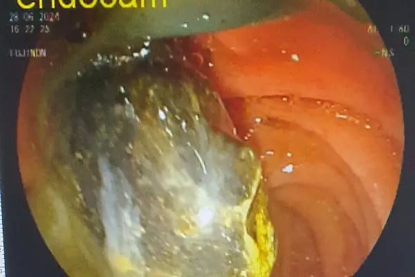 Doç. Dr. Güray Can - Resim 16