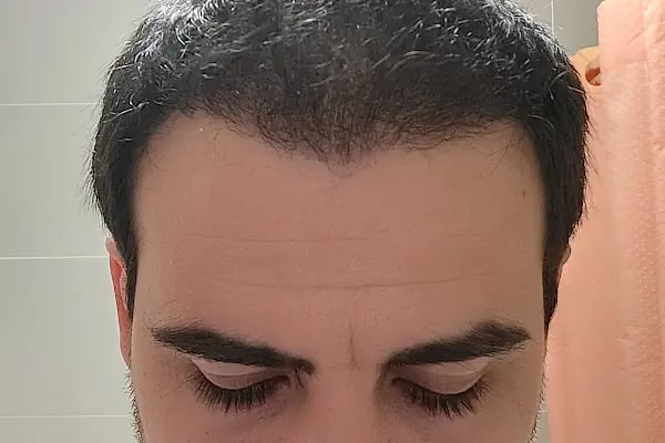 DRKAYA CLINIC - Resim 14