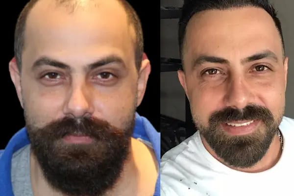 DRKAYA CLINIC - Resim 18