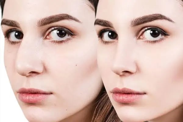 Op.Dr. Mehmet Doğan- Estetik, Plastik ve Rekonstrüktif Cerrahi Kliniği - Resim 2