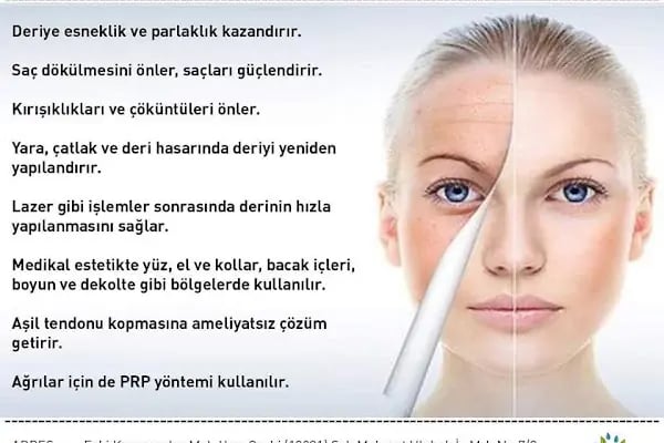 ORTO TERAPİ Op.Dr. Feyyaz Çiftçi - Resim 12