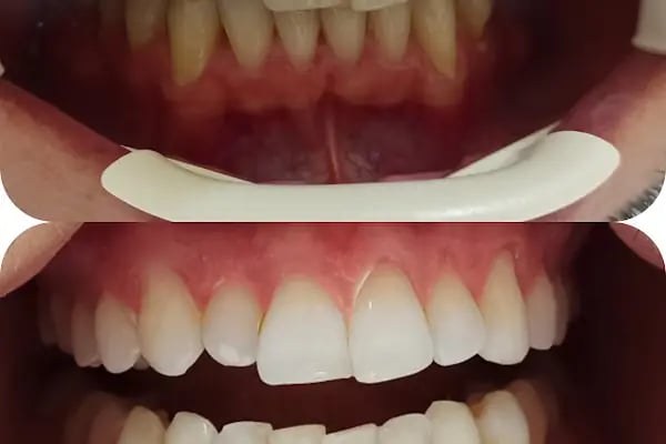 Prof. Dr. Sinan TOZOĞLU - Ağız, Diş ve Çene Cerrahı - Resim 3