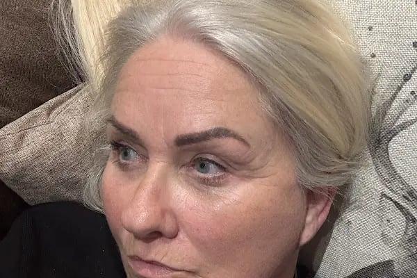 Op. Dr. Bahadır Çelik Estetik ve Plastik Cerrahi Uzmanı - Resim 6