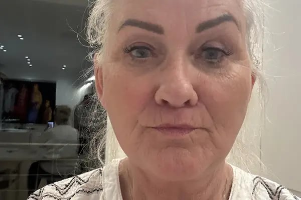 Op. Dr. Bahadır Çelik Estetik ve Plastik Cerrahi Uzmanı - Resim 8