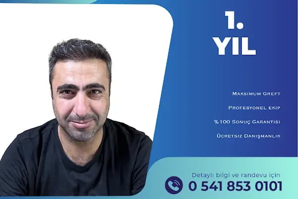 MELTEM ARGUNŞAH SAÇ EKİMİ - DHI, Sapphire &amp; Fue Hair Transplant - Resim 16