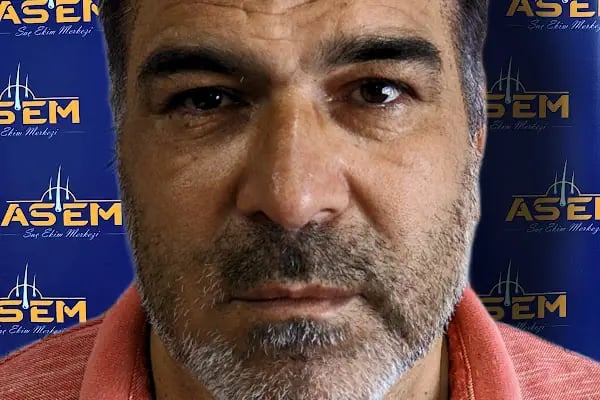 GAZİANTEP Assem Saç Ekim Merkezi - Resim 11