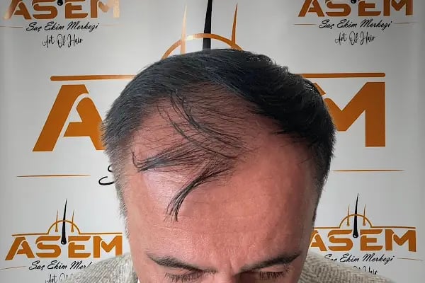 GAZİANTEP Assem Saç Ekim Merkezi - Resim 7
