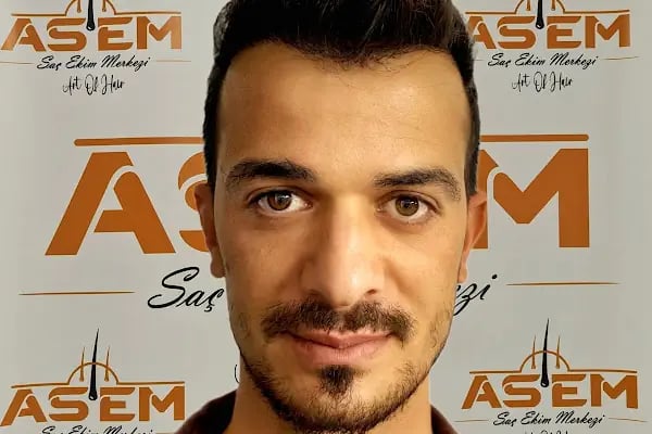 GAZİANTEP Assem Saç Ekim Merkezi - Resim 10