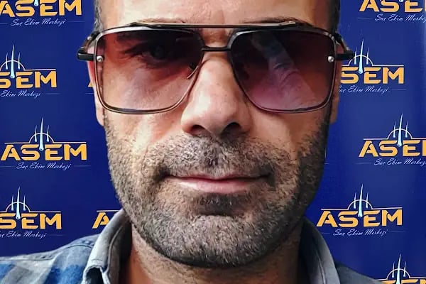 GAZİANTEP Assem Saç Ekim Merkezi - Resim 9