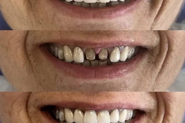 Diş Hekimi Uğur Koçak - Resim 18