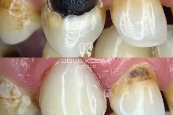 Diş Hekimi Uğur Koçak - Resim 11