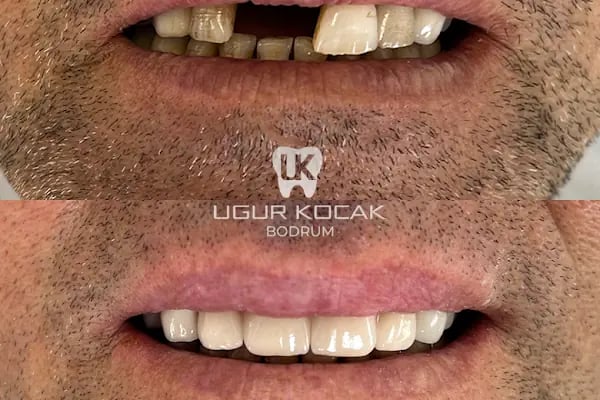 Diş Hekimi Uğur Koçak - Resim 12