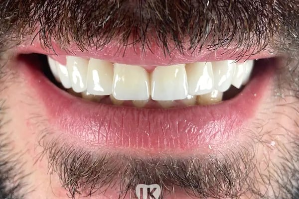 Diş Hekimi Uğur Koçak - Resim 10