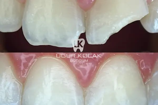Diş Hekimi Uğur Koçak - Resim 16