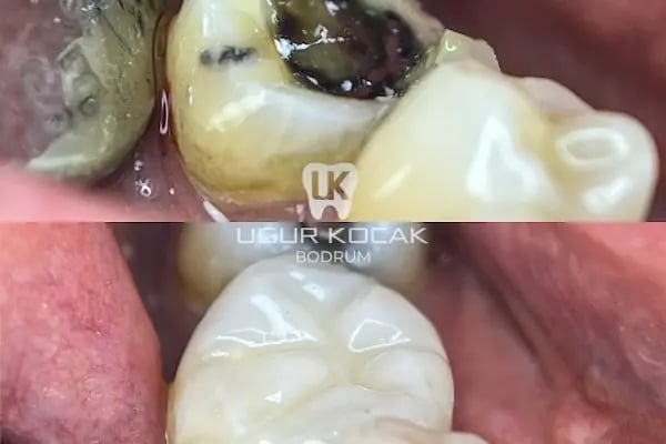 Diş Hekimi Uğur Koçak - Resim 13