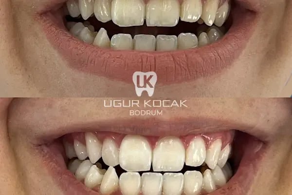 Diş Hekimi Uğur Koçak - Resim 8