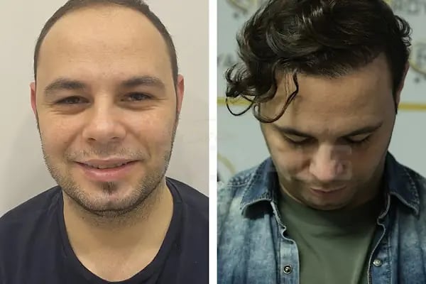 viaTurka İstanbul Medical Aesthetics, Dental &amp; Hair Transplant - Resim 8
