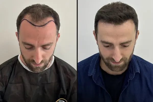 viaTurka İstanbul Medical Aesthetics, Dental &amp; Hair Transplant - Resim 14