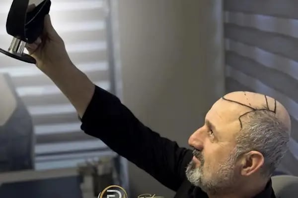 viaTurka İstanbul Medical Aesthetics, Dental &amp; Hair Transplant - Resim 10